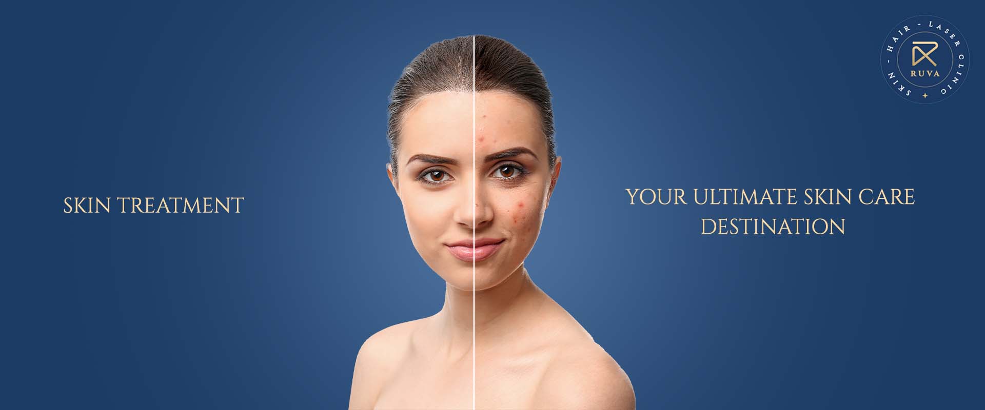 Best Skin Clinic in Mandaveli